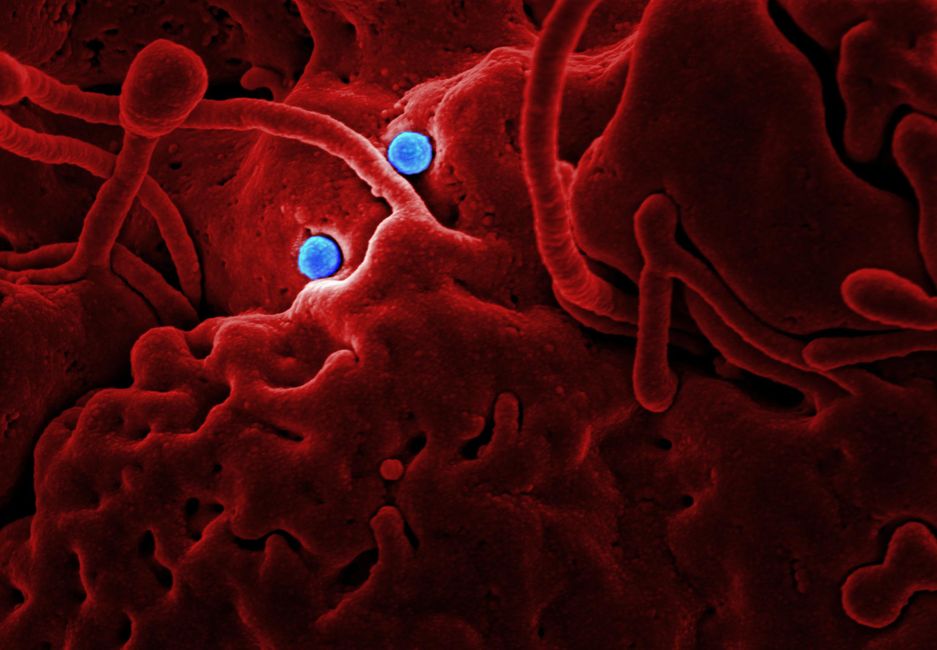 Australian Researchers Discover New Pathway That Could Explain Severe COVID-19