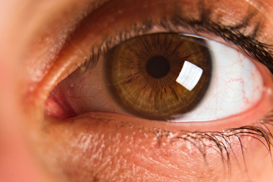 TGA issues blindness warning for Ozempic, Wegovy and Mounjaro over rare eye disorder